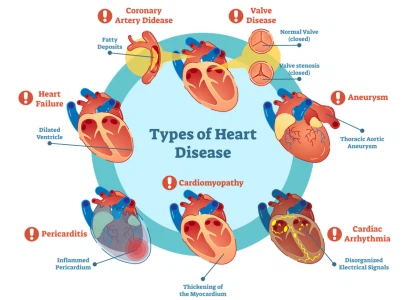 various cardiovascular conditions