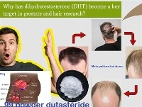 Miksi DHT:sta on tullut eturauhas- ja hiustutkimuksen avainkohde?